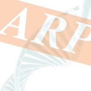25-Hydroxy vitamin D  Rabbit  ELISA Kit